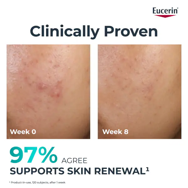 Eucerin Dermopure Clinical Overnight Peeling Treatment 40Ml