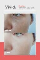 Vivid Retinol Edible Skincare Drops - 60 Capsules