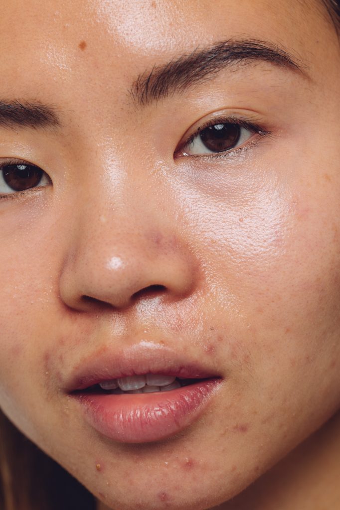 skincare close up
