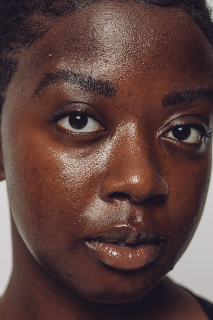 female model showing textured skin
